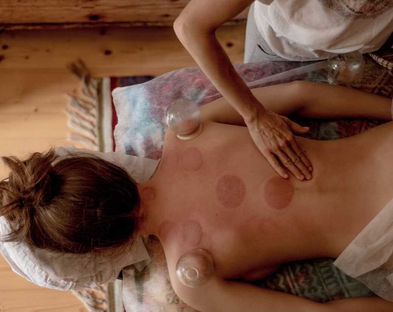 Cupping bekam dan back massage 11 spot Elvara